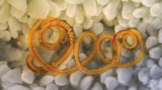 Parasitic helminth worm coiled amongst gut cells