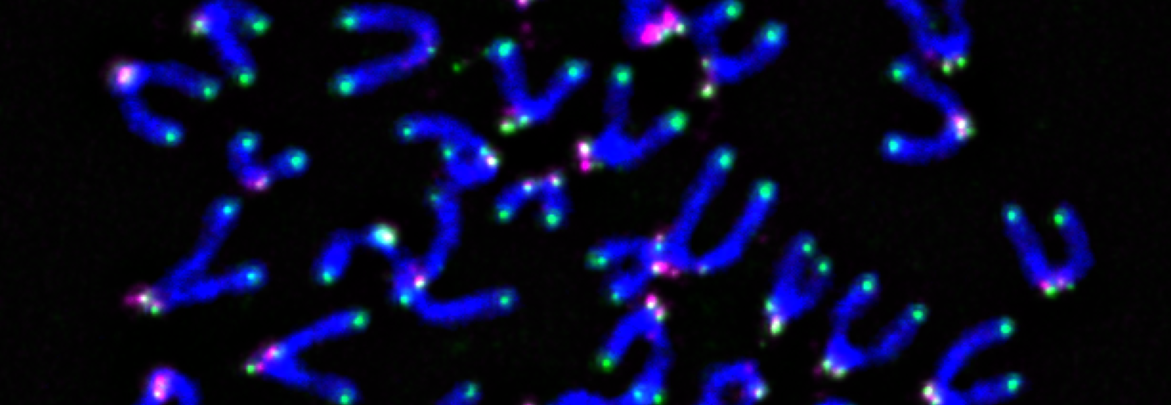 Chromosomes from mouse T cells showing telomeres in green