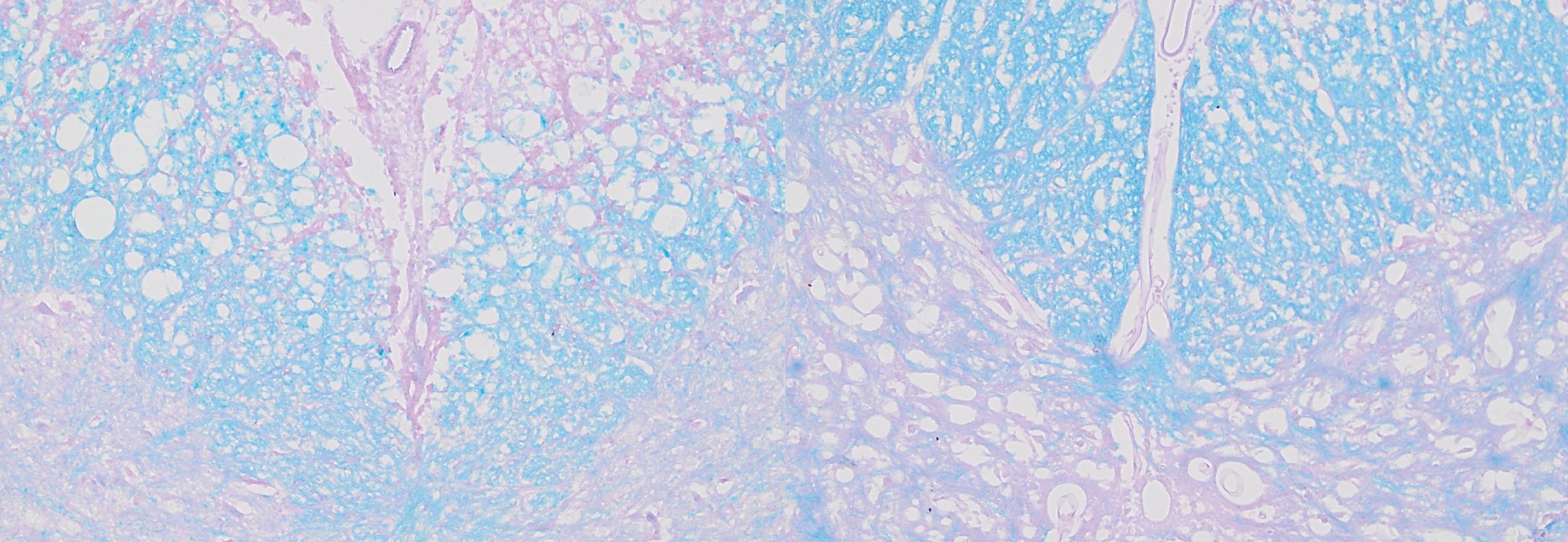 Microscopy images of mouse spinal cords with myelin, the protein that forms the spinal cord's protective sheath, stained blue.