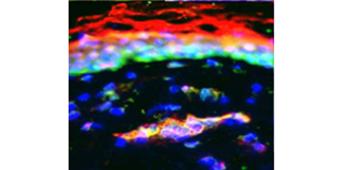Transplant Immunology